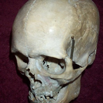 Old Medical Skull