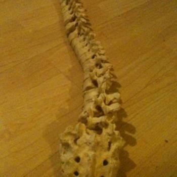 Human Back Spine Doctors example