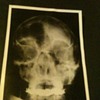 This is a  Bizarre book of Photos from a London Hospital in the 1950's