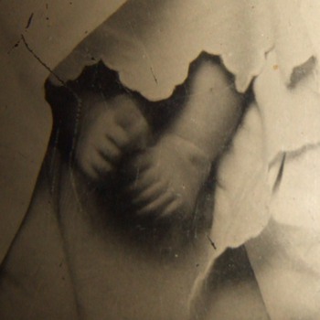 Wiggle toes look like hands with extra digits! - Photographs