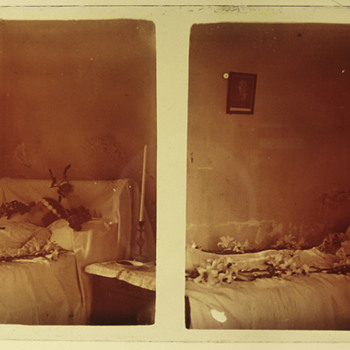 Rare Postmortem Stereogram (19??) - Photographs