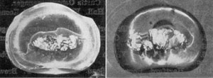 Fragment of an American Paperweight: At the left, this fragment is photographed from the underside to show how small the decorative design of colored glass was. At the right, it is seen as magnified by the spherical curve of the glass casing. Fragment of an American Paperweight: At the left, this fragment is photographed from the underside to show how small the decorative design of colored glass was. At the right, it is seen as magnified by the spherical curve of the glass casing.