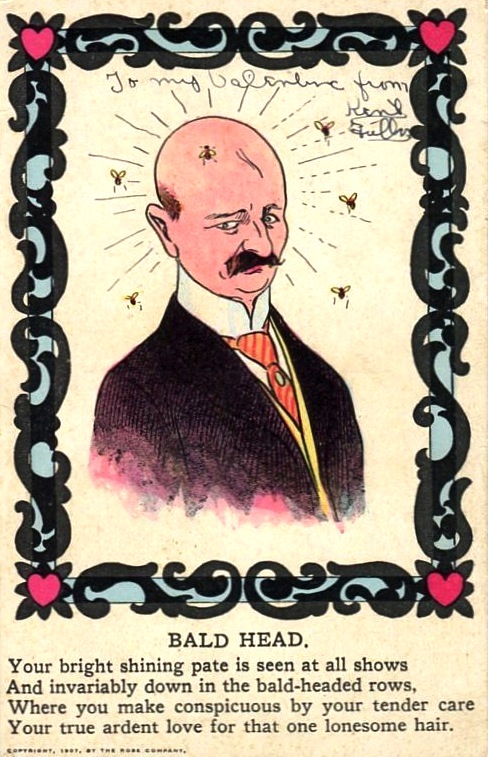 vinegar_bald