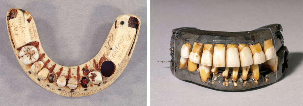 Left, this lower set of Washington's ivory dentures included a hole for his last remaining tooth. Via the New York Academy of Medicine. Right, this complete set of Washington dentures was made from animal and human teeth, ivory, and lead. Via the Mount Vernon Estate.