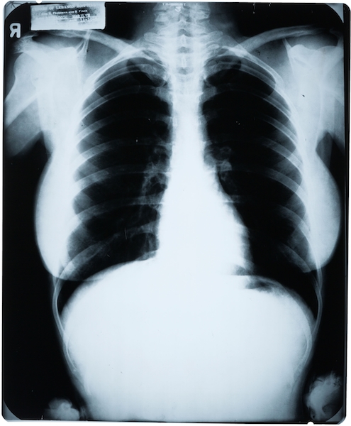 Mantique-edit_A Marilyn Monroe Chest X-Ray, 1954 Yes, it is legal to own a copy of Marilyn Monroe's 1954 chest X-ray. This one sold for $4,687. (Via "Mantiques")