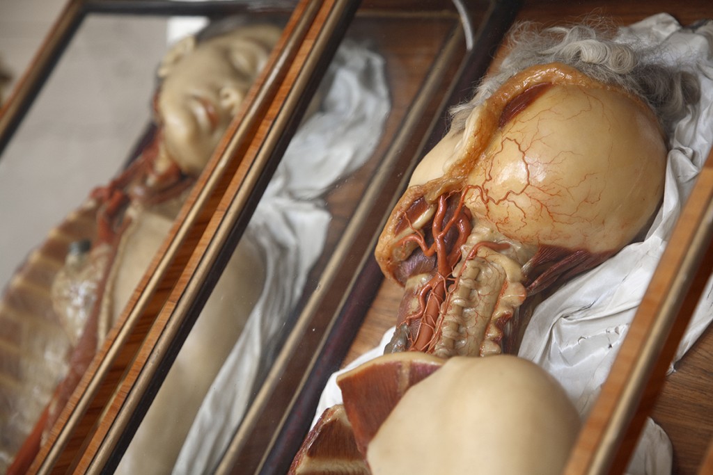 These wax models with human hair were made at La Specola's workshop in Florence, circa 1781–86, and later delivered to the Josephinum Museum in Vienna, Austria. Courtesy the Josephinum, Collections and History of Medicine, MedUni Vienna. Photo © Joanna Ebenstein.