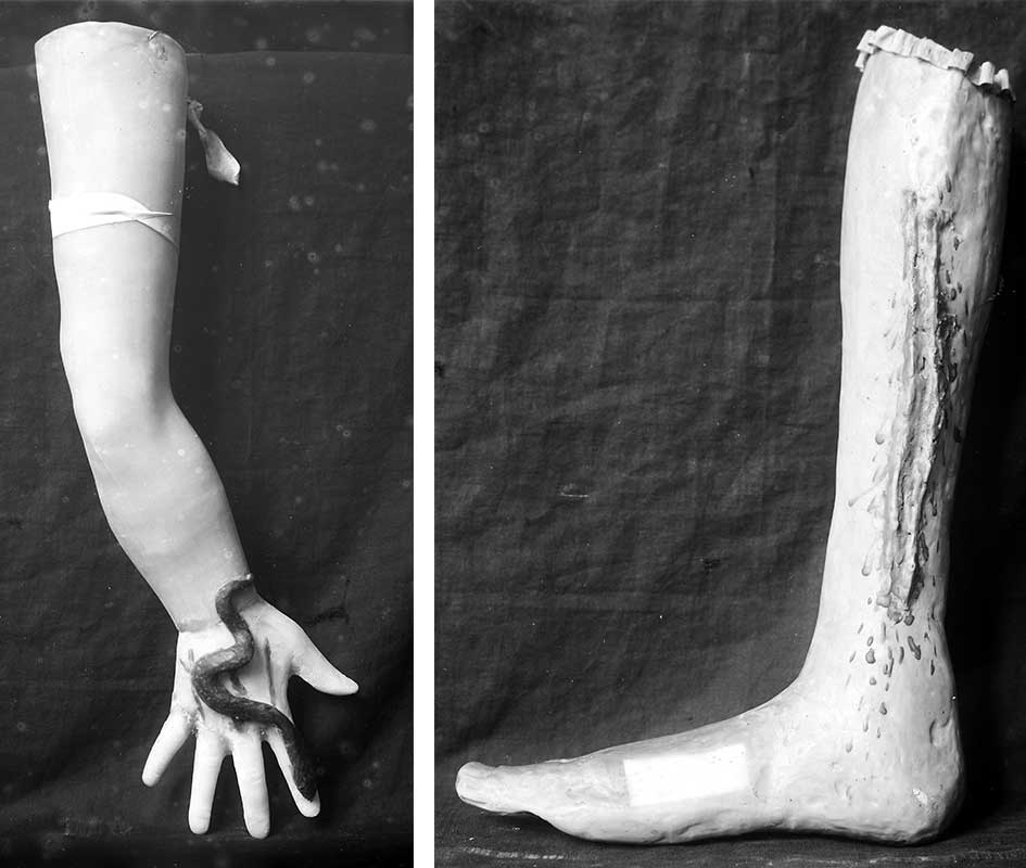 Two wax ex votos showing injuries to the arm and leg. Courtesy the Wellcome Library, London.