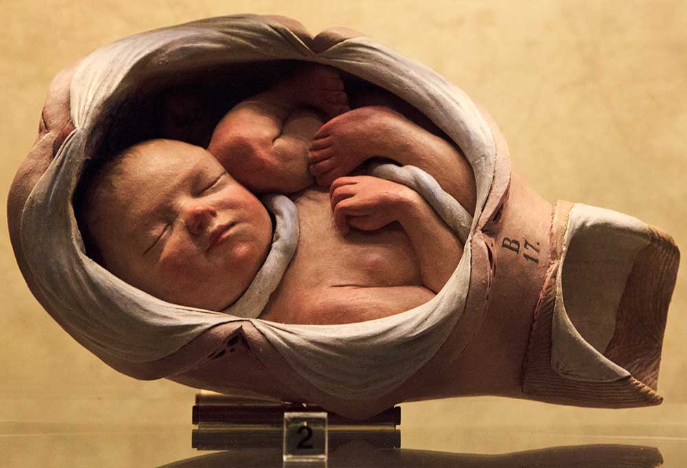 A plaster obstetric model made by Giovanni Battista Sandri for the School of Surgery at the University of Bologna in the mid-18th century. Courtesy the Museo di Palazzo Poggi. Photo © Joanna Ebenstein.