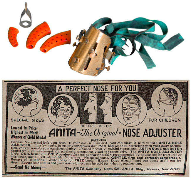The "Anita" Nose Adjuster promised to reshape one's nose without surgery, which author Maurice Collins describes as "the ultimate in nasal quackery.”